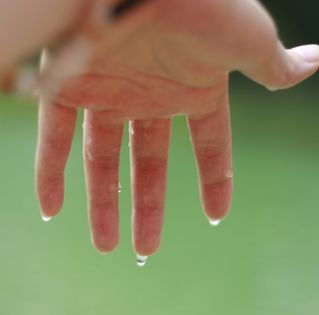 Hiperhidrosis